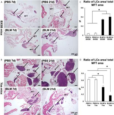 Dual Effect of Bleomycin on Histopathological Features of Lungs and Mediastinal Fat-Associated Lymphoid Clusters in an Autoimmune Disease Mouse Model